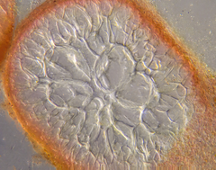 Mychodea spinulifera