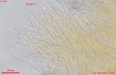 Parachnopeziza miniopsis