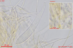 Parachnopeziza miniopsis