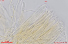 Parachnopeziza miniopsis