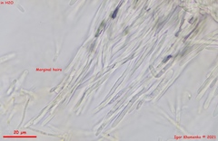 Parachnopeziza miniopsis