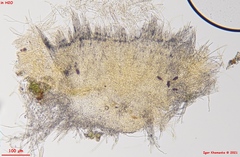 Parachnopeziza miniopsis