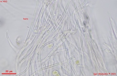 Parachnopeziza miniopsis