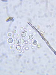 Eucapsis