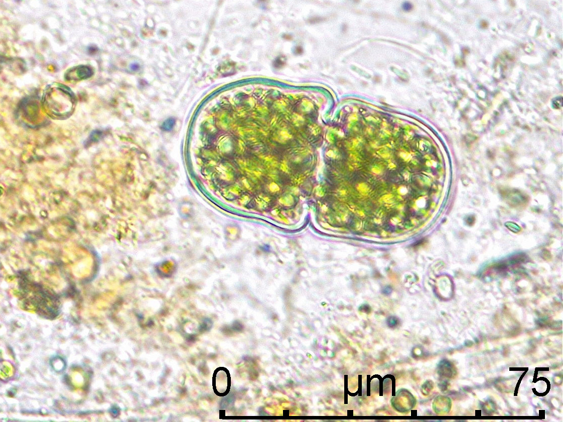 Cosmarium quadratum