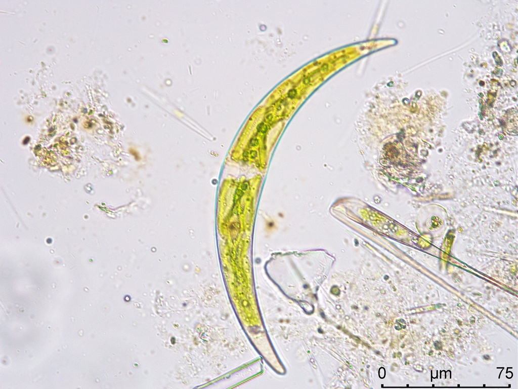 Closterium dianae