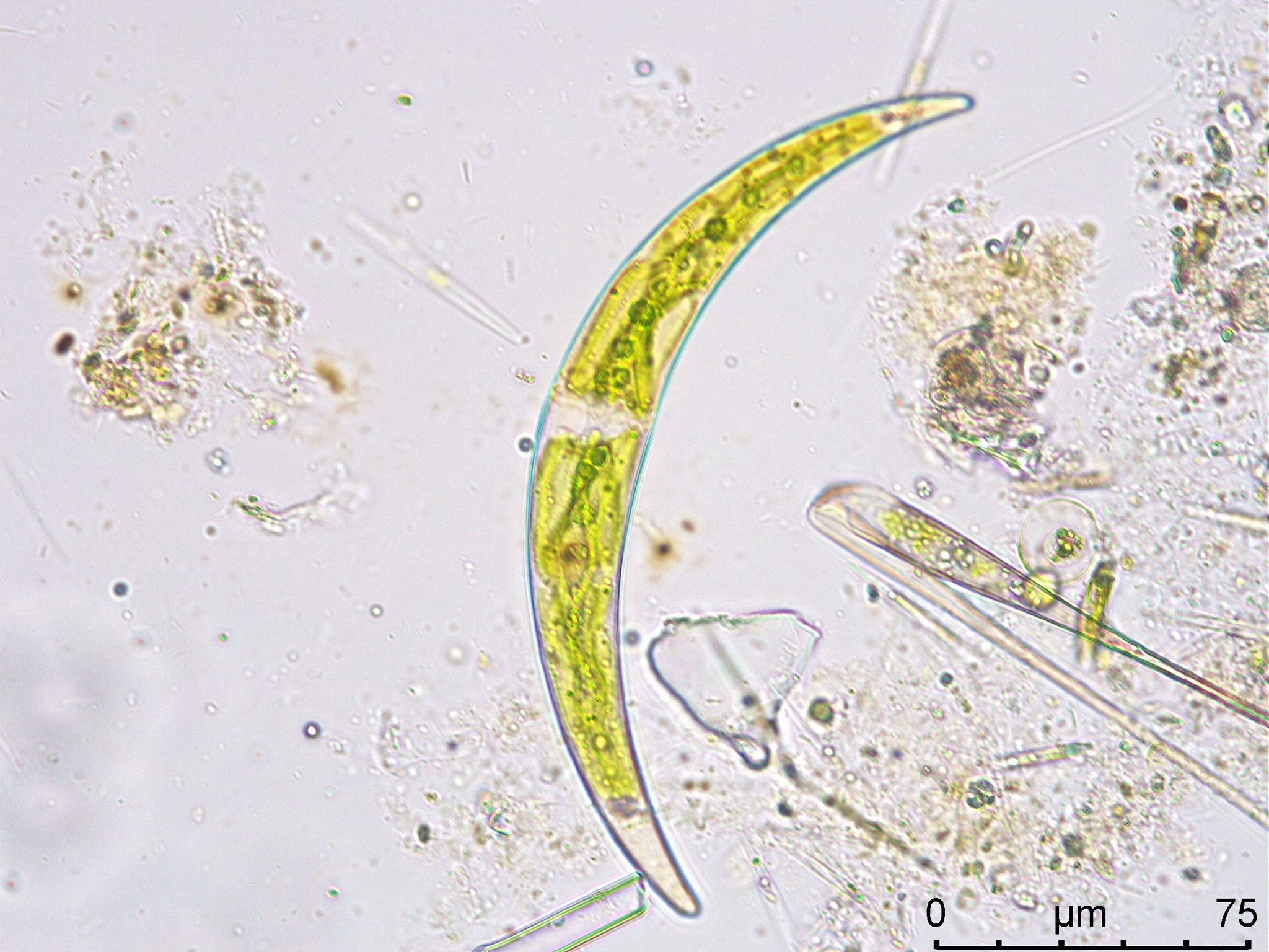 Closterium dianae