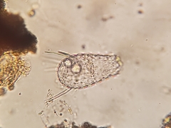 Euglypha acanthophora