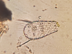 Euglypha acanthophora
