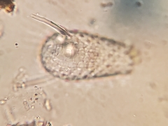 Euglypha acanthophora