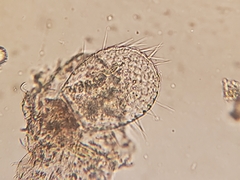 Placocista spinosa