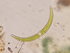Closterium archerianum
