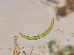 Closterium archerianum