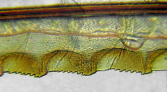 Tenthredopsis scutellaris