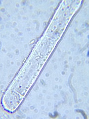 Rhizoclonium