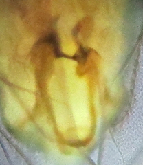 Ectopsocopsis cryptomeriae