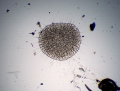 Actinosphaerium eichhornii