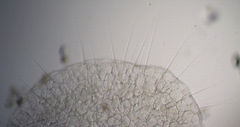 Actinosphaerium eichhornii