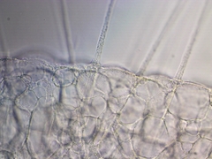 Actinosphaerium eichhornii