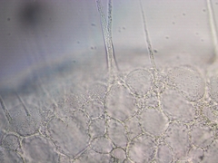 Actinosphaerium eichhornii
