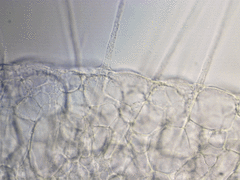 Actinosphaerium eichhornii