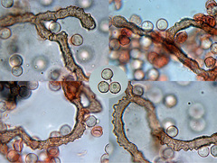 Arcyria stipata