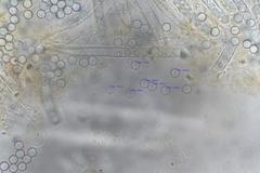 Pulvinula archeri