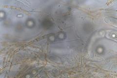 Octospora maireana