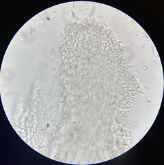 Tricholoma intermedium