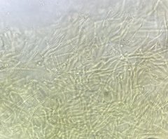 Tricholoma intermedium