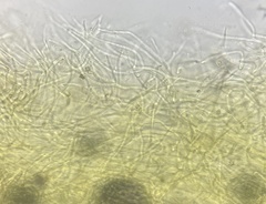 Tricholoma intermedium