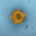 Middle east respiratory syndrome-related coronavirus - Photo 
National Institute of Allergy and Infectious Diseases, National Institutes of Health, sin restricciones conocidas de derechos (dominio público)