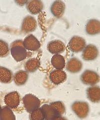 Fossombronia wondraczekii