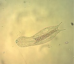 Chaetonotidae