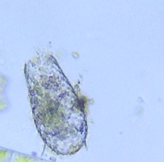 Euglypha acanthophora