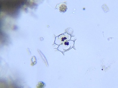 Xanthidium antilopaeum