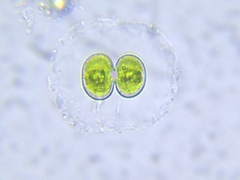 Cosmarium contractum