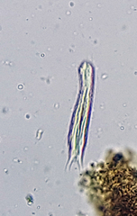 Gastrotricha
