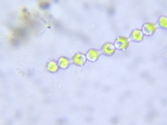 Radiofilum