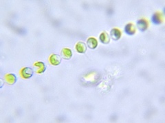 Radiofilum