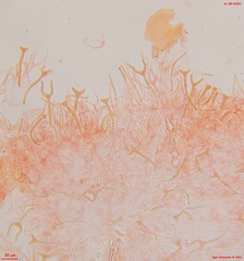 Dacrymyces corticioides