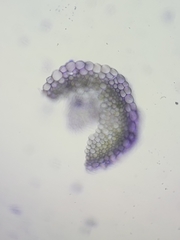 Sphagnum platyphyllum