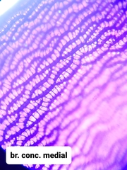 Sphagnum platyphyllum