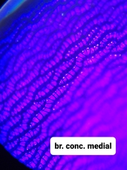 Sphagnum platyphyllum