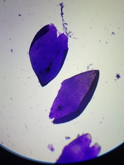 Sphagnum platyphyllum