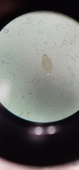 Trichuris vulpis