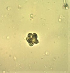 Coelastrum microporum