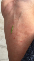 Lepidoptera