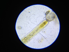 Fischerella
