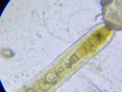 Fischerella